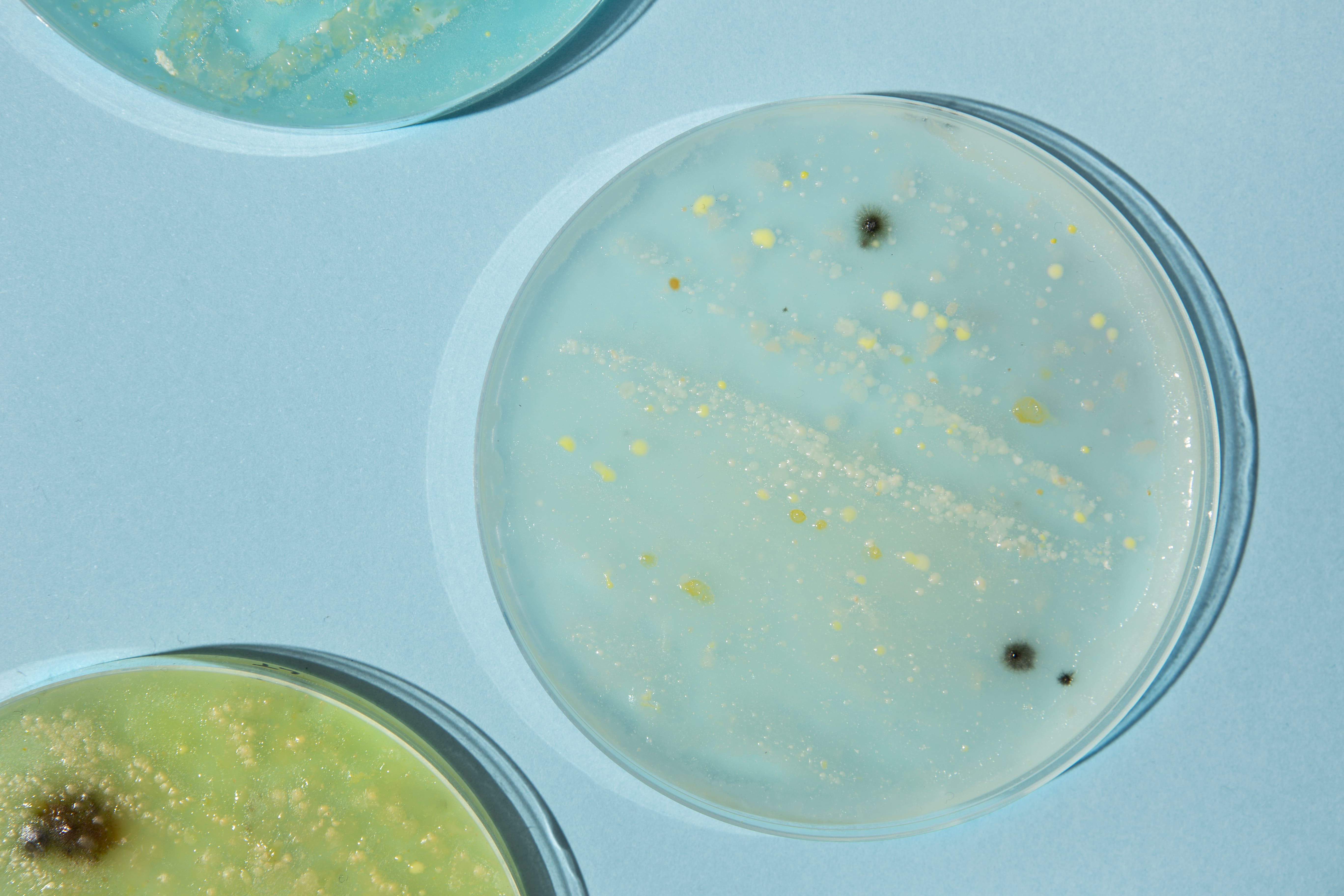 bacterias beneficiosas para la infección de orina 